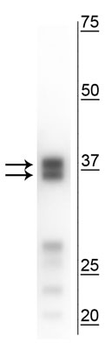 Arginase I (ARG1) Antibody