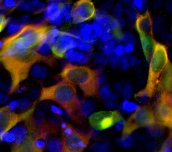 CRISPR Cas9 Antibody