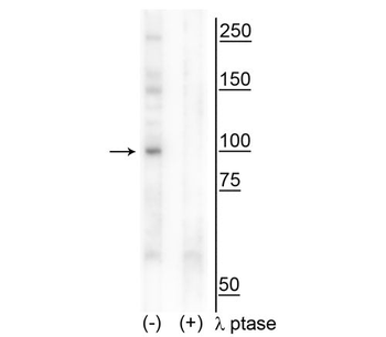 CtIP (Thr847) Antibody