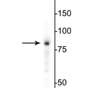 EWS Antibody