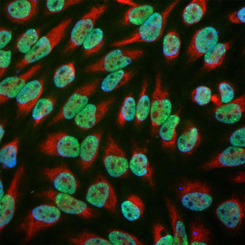 EWS Antibody