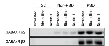 GABAA Receptor ß3 Antibody