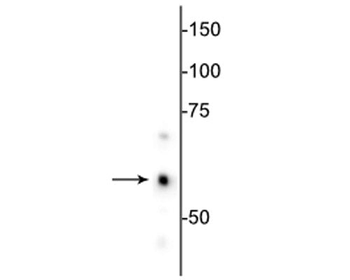 Hsp60 Antibody