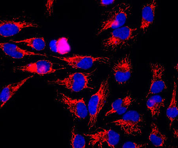 Hsp60 Antibody