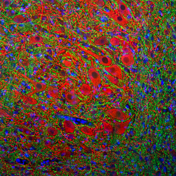 Microtubule Associated Protein 2 (MAP2) Antibody