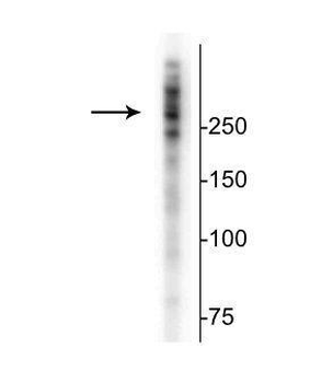 Microtubule Associated Protein 2 (MAP2) Antibody