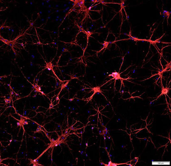 Microtubule Associated Protein 2 (MAP2) Antibody
