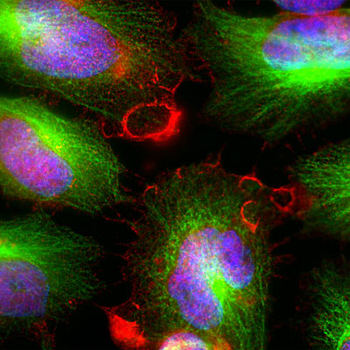 MARCKS Antibody