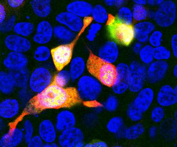 mCherry Antibody