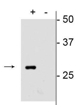 mCherry Antibody