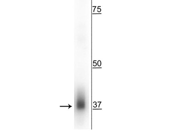 Mitochondrial Fission Factor (MFF) Antibody