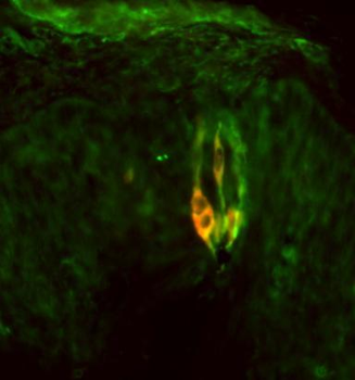 Phospholipase C β2 (PLC-β2) Antibody