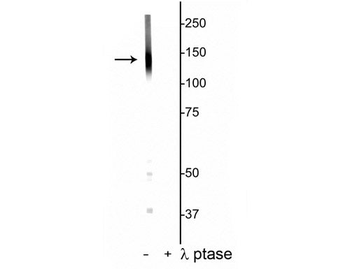 Potassium Chloride Cotransporter (KCC2) (Thr1007) Antibody