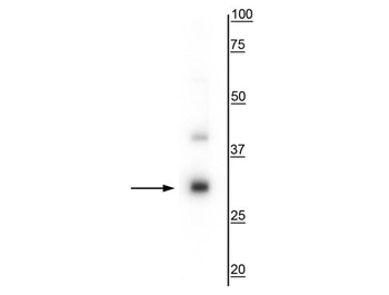 TREM2 Antibody