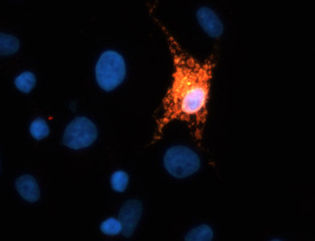 TREM2 Antibody