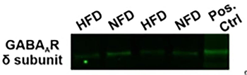 GABAA Receptor δ, N-Terminus Antibody