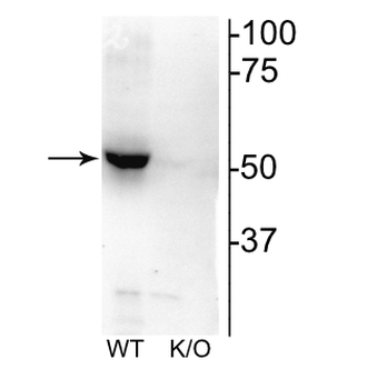 Nicotinic Acetylcholine Receptor (nAChR) β2 Antibody