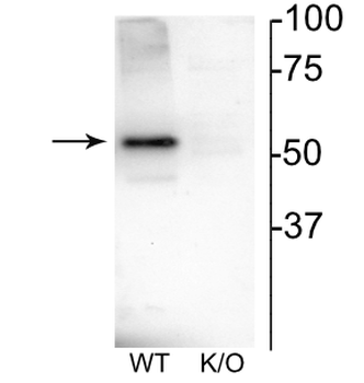 Nicotinic Acetylcholine Receptor (nAChR) β4 Antibody