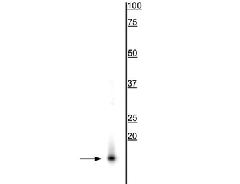 Alpha Synuclein Antibody