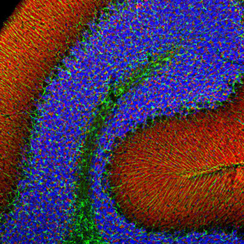 Alpha Synuclein Antibody