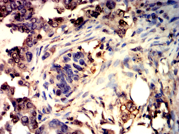 TGFB1 Antibody