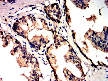 IL1B interleukin 1 beta Antibody
