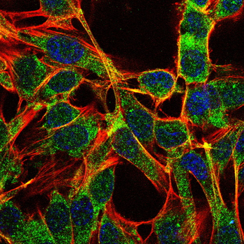 PI3K p85 alpha/Gamma Rabbit Polyclonal Antibody