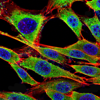 CD31 Rabbit Polyclonal Antibody