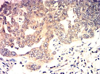 RUNX1+RUNX2+RUNX3 Antibody