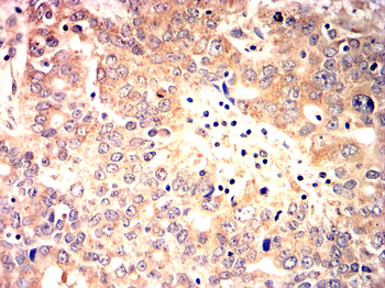 HSPA5 Antibody