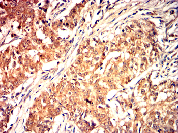 HSPA5 Antibody