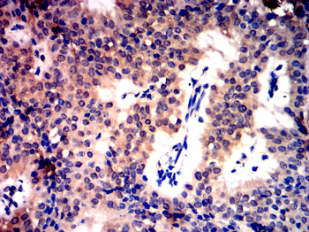 ZEB1 Antibody