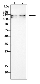 ZEB1 Antibody