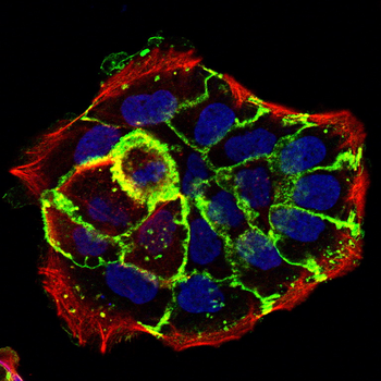 EGFR Rabbit Polyclonal Antibody