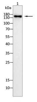 EGFR Rabbit Polyclonal Antibody