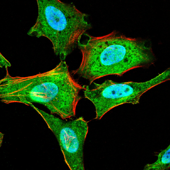 SMAD1/5/9 Antibody