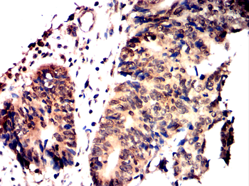 JAK1 Antibody