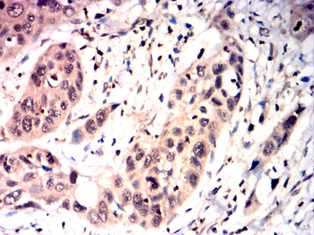 JAK1 Antibody