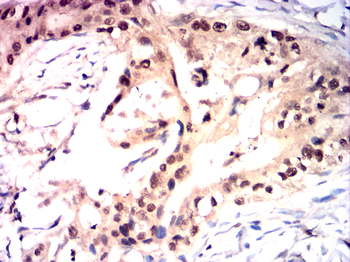 JAK1 Antibody