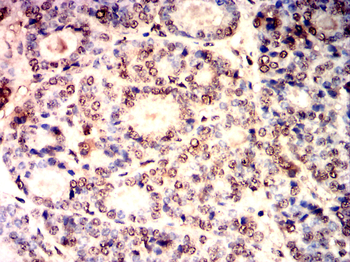 TWIST1 Antibody