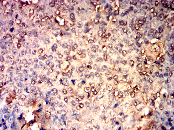 SREBF1 Antibody