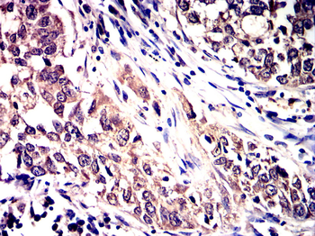 RPS6KB1 Antibody