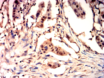 SMAD2 Antibody