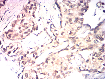 ESR2 Antibody