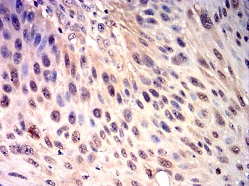 HSPA1A Antibody