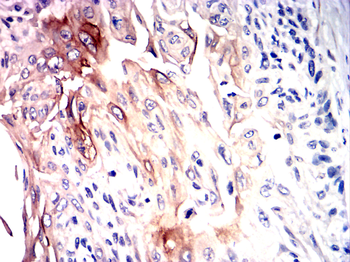 KIT Antibody