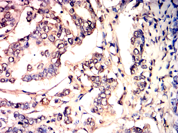 SIRT3 Antibody
