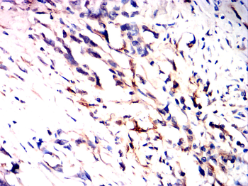 GSDMD Antibody