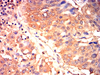 BCL2L1 Antibody