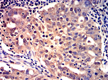 Mitofusin-1 Antibody